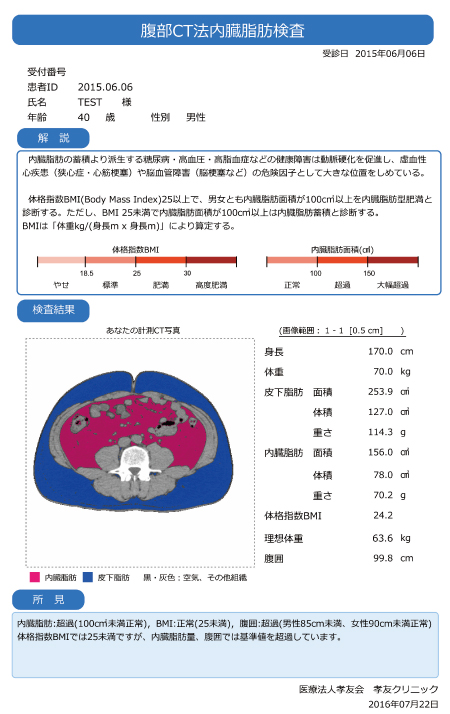 腹部CT法内臓脂肪検査